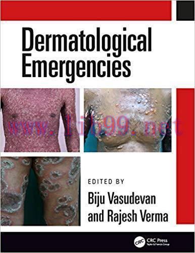 [PDF]Dermatological Emergencies [Biju Vasudevan]