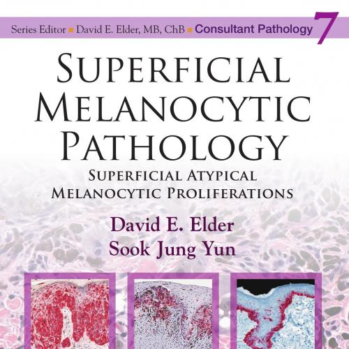 Superficial Melanocytic Pathology