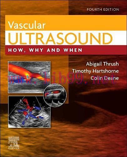 [AME]Vascular Ultrasound: How, Why and When, 4th edition (True PDF)