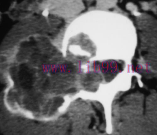 [AME]MRI Mastery Series: Degenerative Joint Disease (DJD) 2020 (CME VIDEOS)