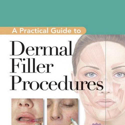 Practical Guide to Dermal Filler Procedures