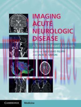 [AME]Imaging Acute Neurologic Disease: A Symptom-Based Approach (ORIGINAL PDF from_ Publisher)