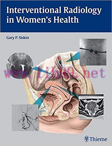 [PDF]Interventional Radiology in Women&rsquo;s Health, 1e [Thieme] [2009]