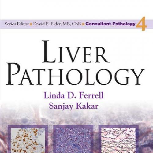 Liver Pathology by Linda Ferrell