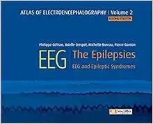 [AME]Atlas of electroencephalography:The Epilepsies. EEG and epileptic syndromes, Volume 2 (Ori...