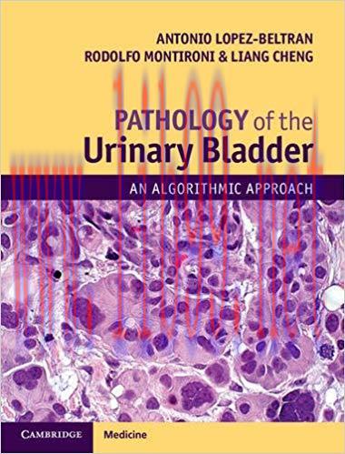 [CHM]Pathology of the Urinary Bladder - An Algorithmic Approach