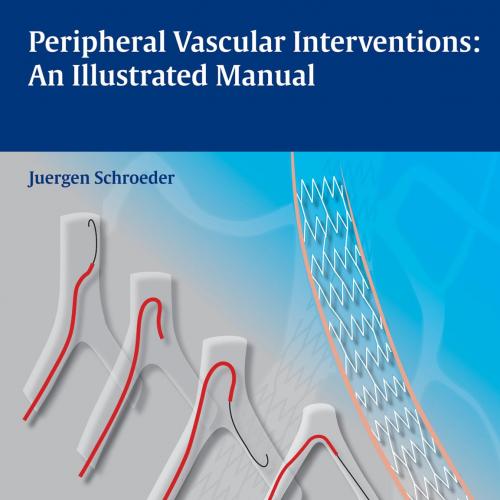 Peripheral Vascular Interventions-An Illustrated Manual
