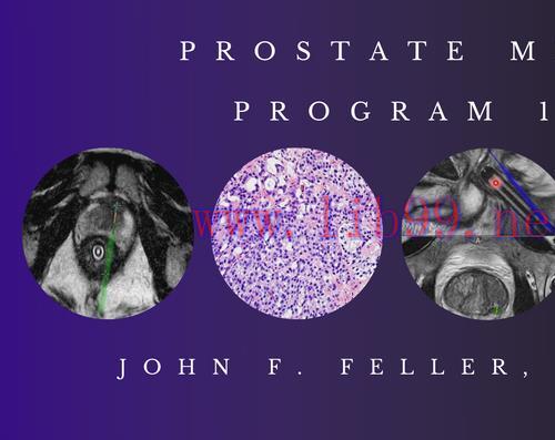 [AME]Prostate MRI (Program 1) - John F. Feller, M.D. (CMEScience) (CME Videos)