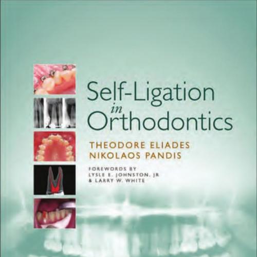 Self-Ligation in Orthodontics