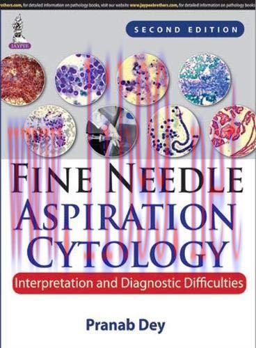 [AME]Fine Needle Aspiration Cytology: Interpretation and Diagnostic Difficulties, 2nd Edition (...