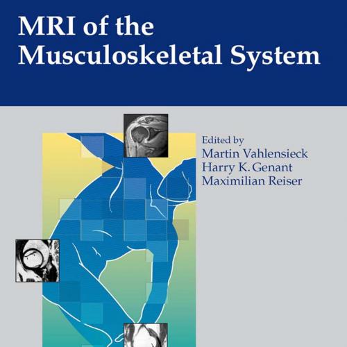 MRI of the Musculoskeletal System - Vahlensieck, Martin,Genant, Harry