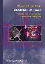 [PDF]Schädelbasischirurgie: Robotik, Neuronavigation, vordere Schädelgrube
