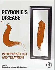 Peyronie&rsquo;s Disease Pathophysiology and Treatment