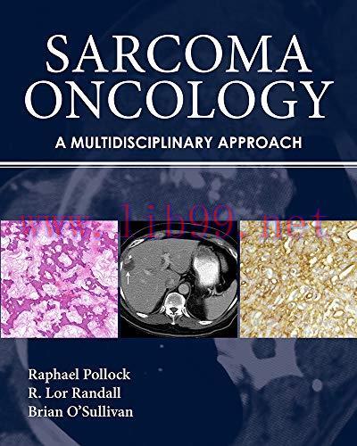 [AME]Sarcoma Oncology: A Multidisciplinary Approach (PDF)