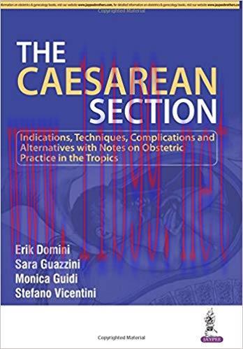 [PDF]The Caesarean Section