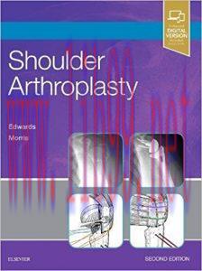 [AME]Shoulder Arthroplasty, 2e (Original PDF)
