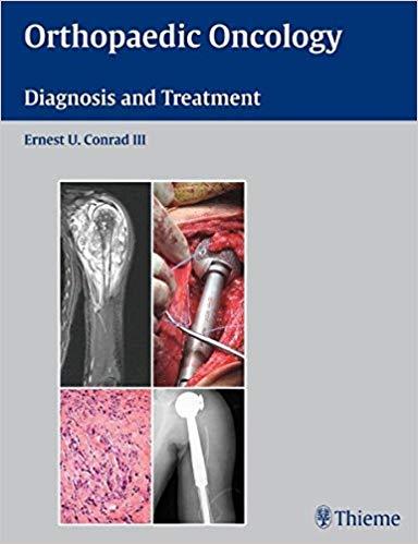 Orthopaedic Oncology - Diagnosis and Treatment