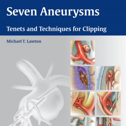 Seven Aneurysms_ Tenets and Techniques for Clipping