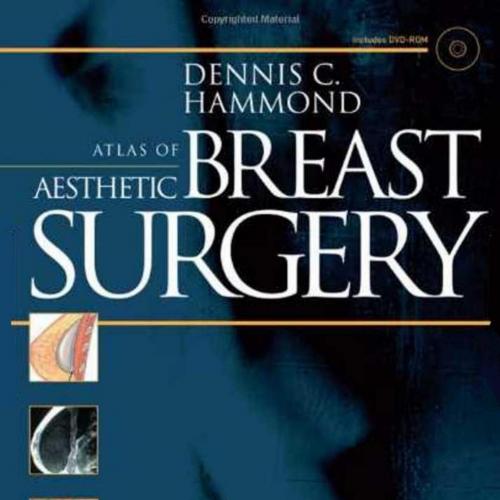 Atlas of Aesthetic Breast Surgery