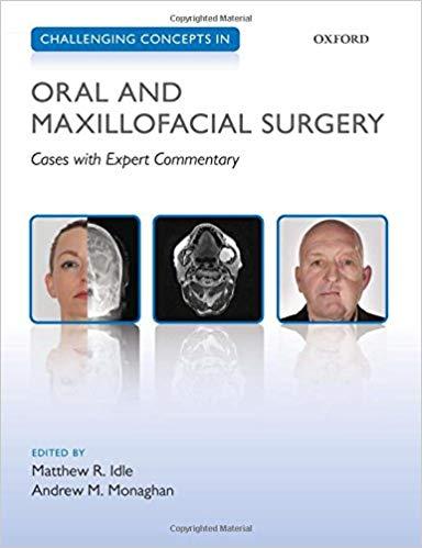 Challenging Concepts in Oral and Maxillofacial Surgery