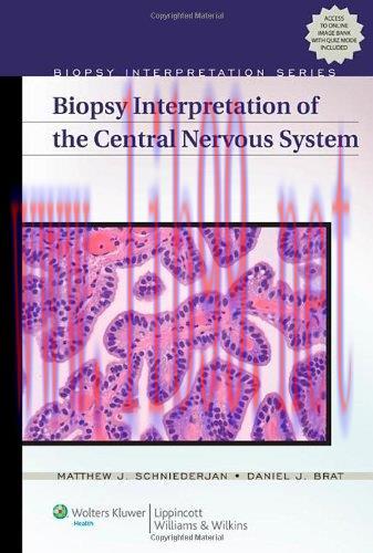 [AME]Biopsy Interpretation of the Central Nervous System (Biopsy Interpretation Series)
