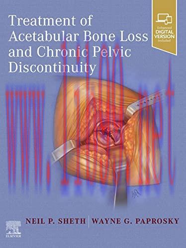 [PDF]Treatment of Acetabular Bone Loss and Chronic Pelvic Discontinuity