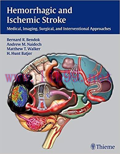 [PDF]Hemorrhagic and Ischemic Stroke + Video