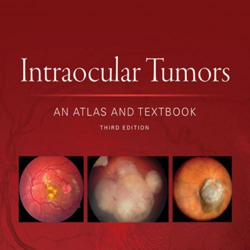Intraocular Tumors_ An Atlas and Textbook 3rd - Jerry A. Shields,Carol L. Shields
