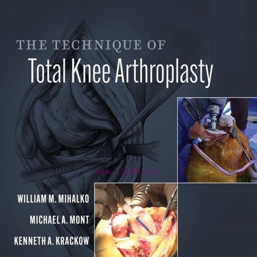 [AME]The Technique of Total Knee Arthroplasty, 2nd Edition (EPUB)