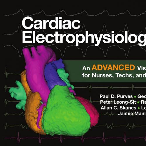Cardiac Electrophysiology 2 An Advanced Visual Guide for Nurses,Techs,and Fellows,2E
