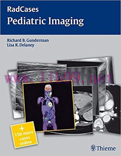 [PDF]RadCases Pediatric Imaging