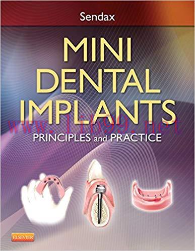 [PDF]Mini Dental Implants - Principles and Practice