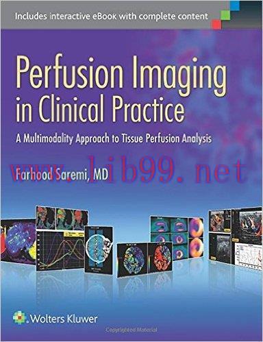 [AME]Perfusion Imaging in Clinical Practice: A Multimodality Approach to Tissue Perfusion Analy...