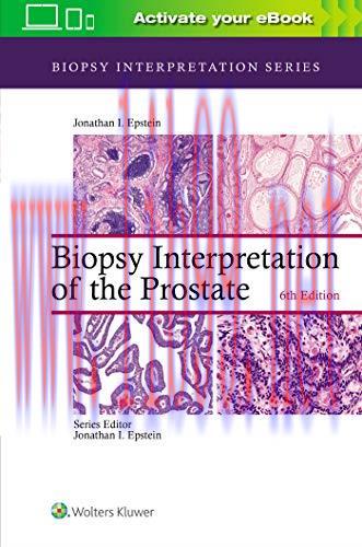 [AME]Biopsy Interpretation of the Prostate (Biopsy Interpretation Series), 6th Edition (EPUB)