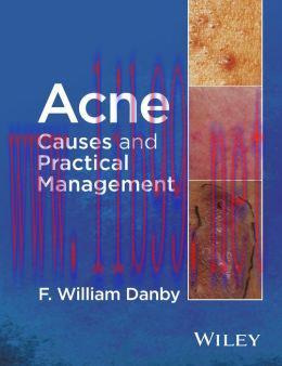 [AME]Acne: Causes and Practical Management