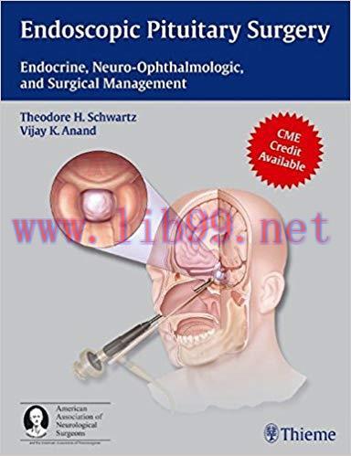 [PDF]Endoscopic Pituitary Surgery