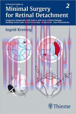 [AME]A Practical Guide to Minimal Surgery for Retinal Detachment, Volume 2