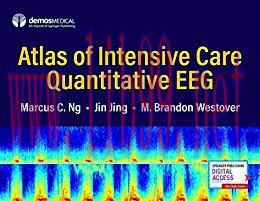 (PDF)Atlas of Intensive Care Quantitative EEG