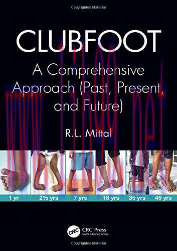 [AME]Clubfoot: A Comprehensive Approach (Past, Present, and Future) (PDF)