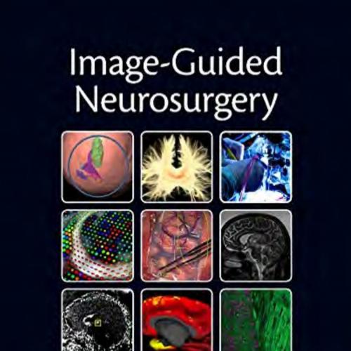 Image-Guided Neurosurgery 2015