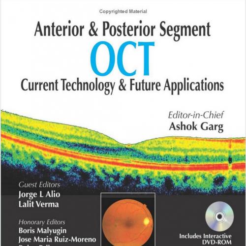 Anterior and Posterior Segment OCT Current Technology and Future Applications - Wei Zhi