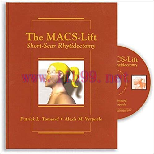 [PDF]The MACS-Lift - Short-Scar Rhytidectomy + Videos