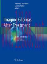 [PDF]Imaging Gliomas After Treatment: A Case-based Atlas