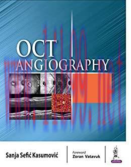 [AME]OCT Angiography (Original PDF)