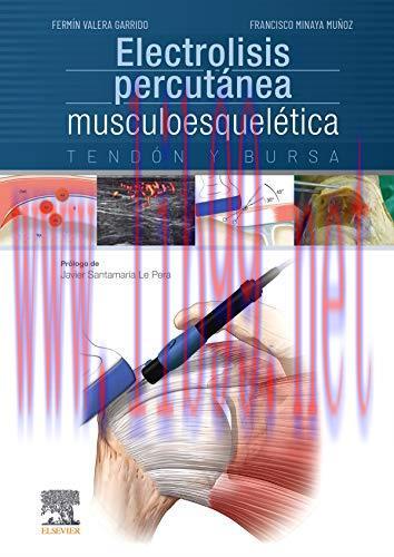 [AME]Electrolisis percut&aacute;nea musculoesquel&eacute;tica. Tend&oacute;n y bursa (Spanish Edition) (Original PDF...