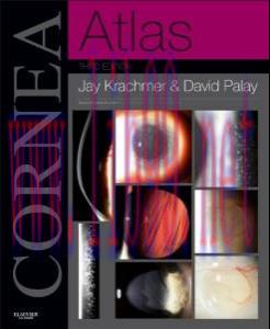 [AME]Cornea Atlas: Expert Consult &ndash; Online and Print, 3rd (Original PDF)