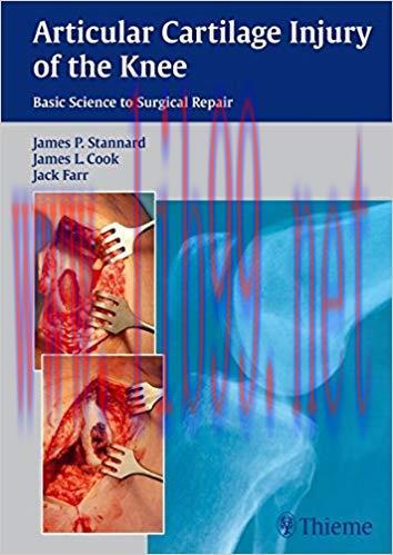 [PDF]Articular Cartilage Injury of the Knee