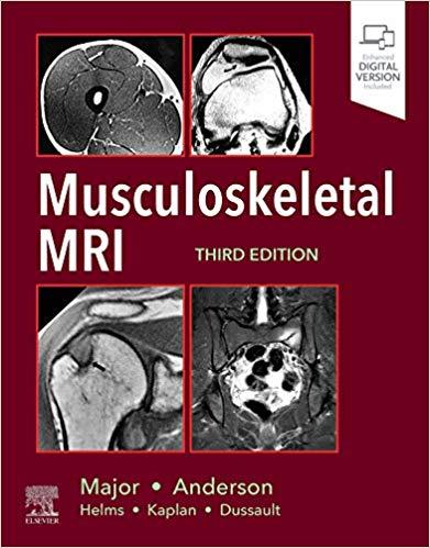 Musculoskeletal MRI, Third Edition