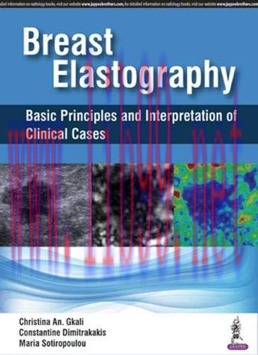 [AME]Breast Elastography: Basic Principles and Interpretation of Clinical Cases (Original PDF)