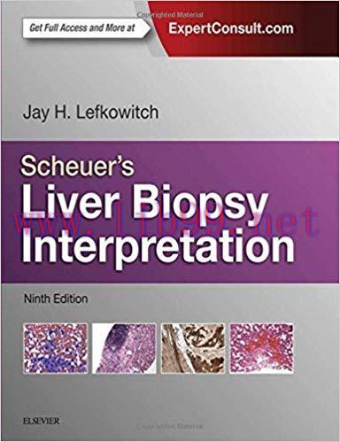 [PDF]Scheuers Liver Biopsy Interpretation 9th Edition